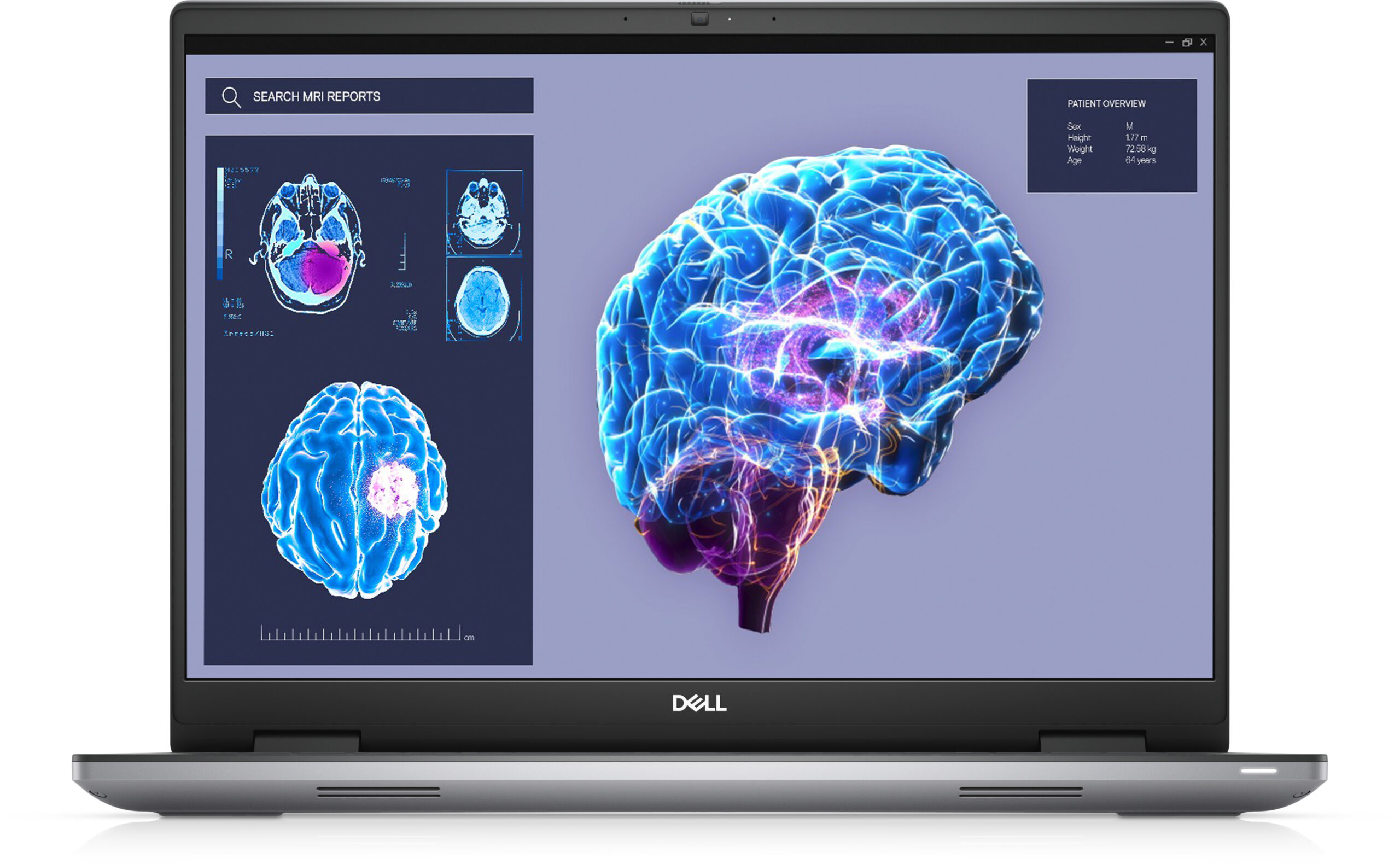 Dell Precision 7000 7680 Business & Performance UK with Intel® Core™ i9, 128GB RAM and storage